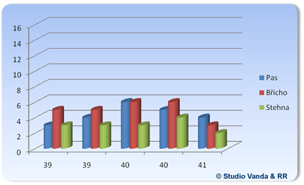 Ultrasonic liposuction results - age group 39 - 41